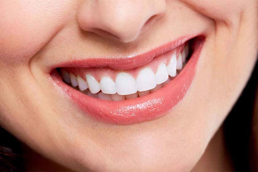 Smile Makeover- How Can You Get That Bollywood Smile?