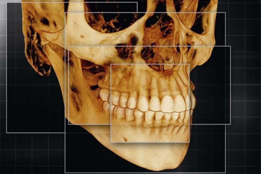 CBCT Dental Scan: What It Is and When You Need One