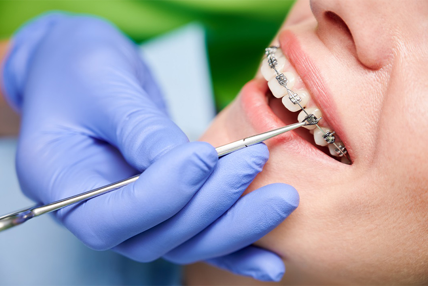 Looking for Orthodontic Treatment? Here’s the Best Orthodontist in Delhi