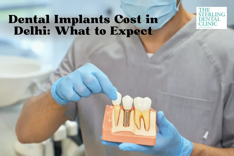 Dental Implant Cost in Delhi: What to Expect