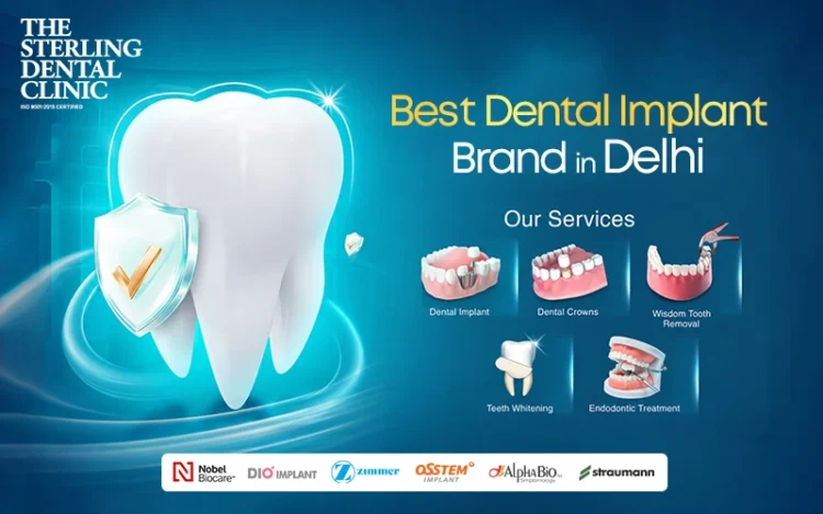 Best Dental Implant Brand in Delhi
