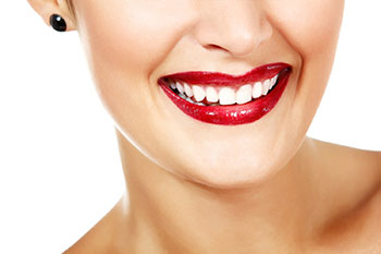Smile Makeover in Delhi | Sterling Dental Clinic